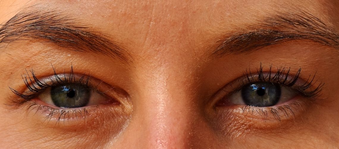 Nistagmus (Göz Titremesi) Nedir? Nedenleri, Belirtileri ve Tedavisi
